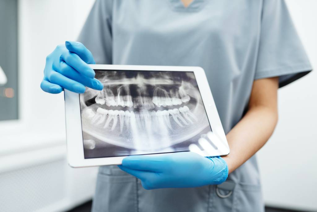 Dental nurse showing a picture of a dental x-ray